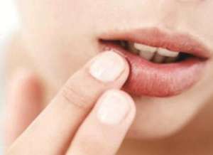 口角炎的原因及防治方法